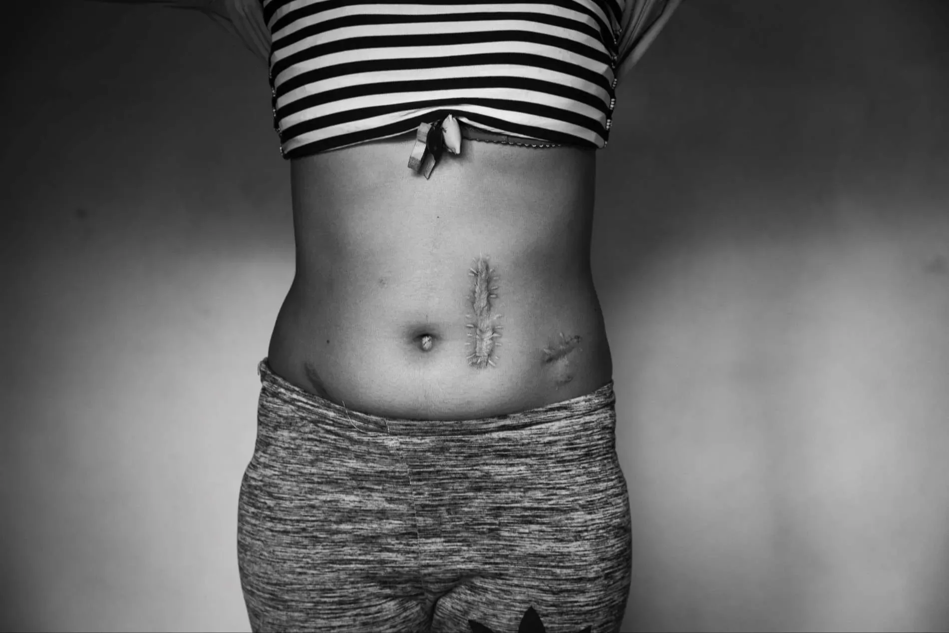 Donna e Reportage — immagine 12